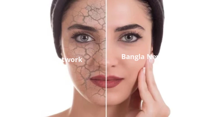 শীতে ৬ উপায়ে দূর করতে পারবেন ত্বকের শুষ্কতা