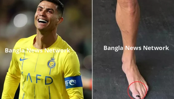 রোনালদো পায়ে কেন নেইল পলিশ লাগান