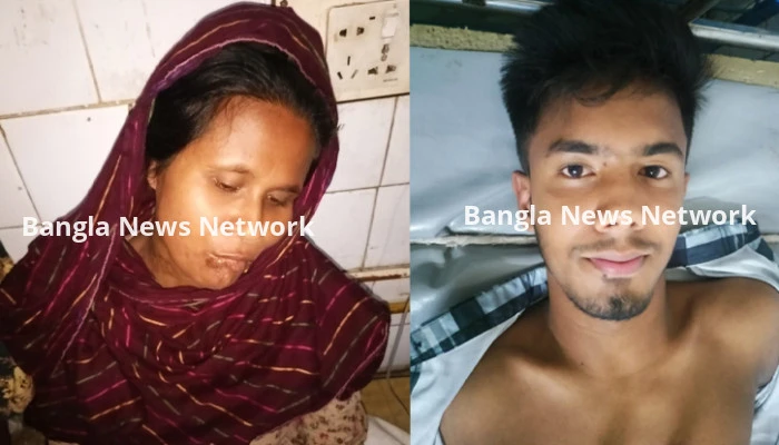 যশোরে সাপের কামড়ে ২ জন হাসপাতালে ভর্তি